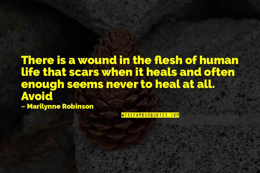 Bereczky Anna Quotes By Marilynne Robinson: There is a wound in the flesh of