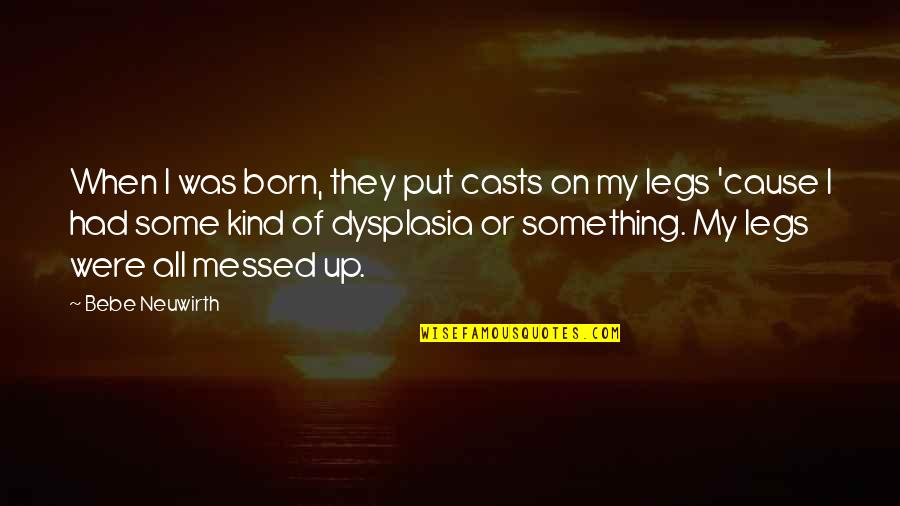 Dysplasia Quotes By Bebe Neuwirth: When I was born, they put casts on