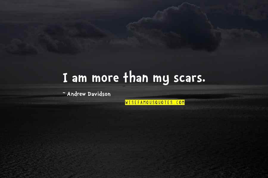 I Am More Than Quotes By Andrew Davidson: I am more than my scars.