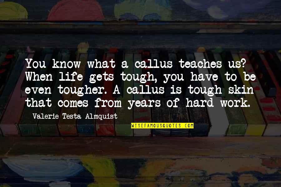 Simbarashe Kwaramba Quotes By Valerie Testa Almquist: You know what a callus teaches us? When