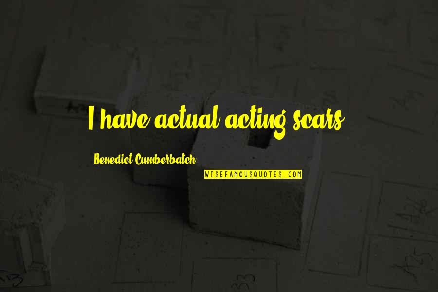 Terbiodegradasi Quotes By Benedict Cumberbatch: I have actual acting scars.