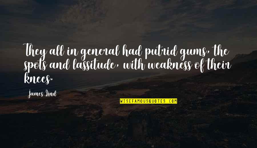 You're My Weakness Quotes By James Lind: They all in general had putrid gums, the